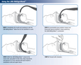 LMA MADgicWand Mucosal Atomizer Device | Mountainside Medical Equipment